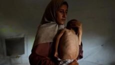 গাজায় অনাহার ও অপুষ্টিতে মৃত্যুর সংখ্যা বেড়ে ২১২
